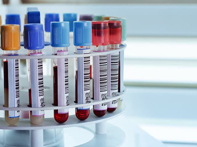 Fiole médicales - étiquettes médicales autocollantes