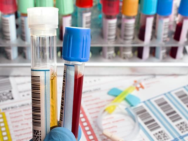 Etiquette adhésive-autocollante-medicament-medical- Santé- température-climatique