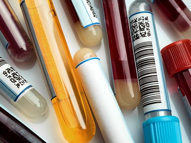 Fiole médicales - étiquettes médicales autocollantes