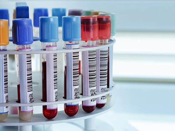 Fiole médicales